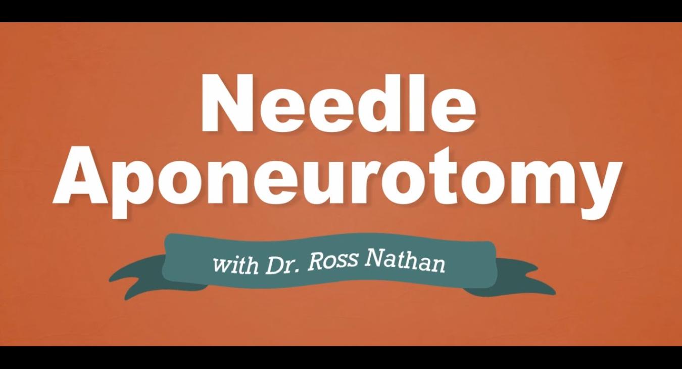 Needle Aponeurotomy - Dupuytren's Contracture Video