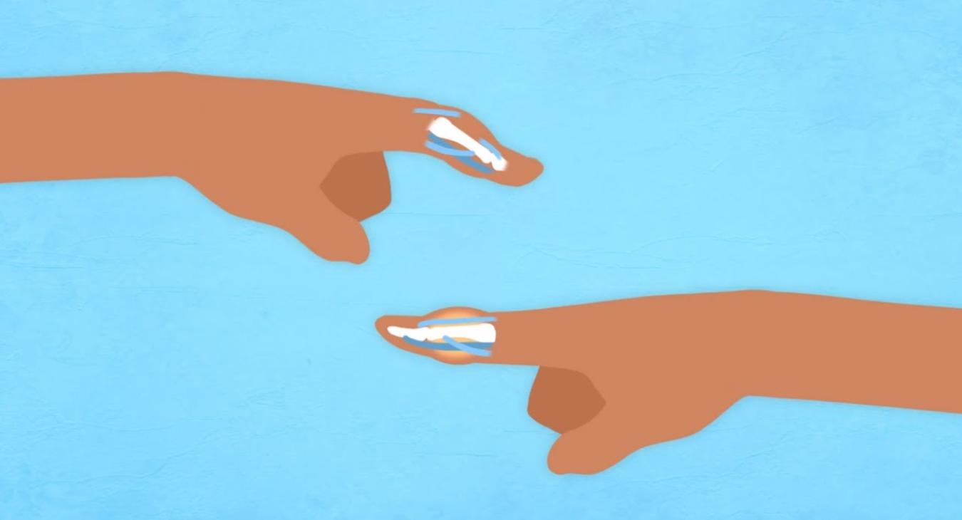 What is a Jammed Finger?