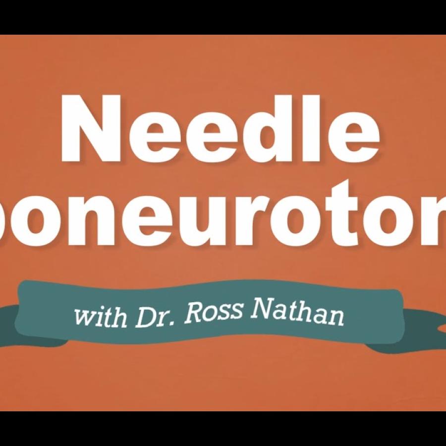 Needle Aponeurotomy - Dupuytren's Contracture Video